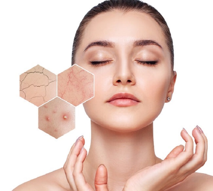 Da nhạy cảm cần lựa chọn các sản phẩm chăm sóc da có dòng chữ “Sensitive Skin”